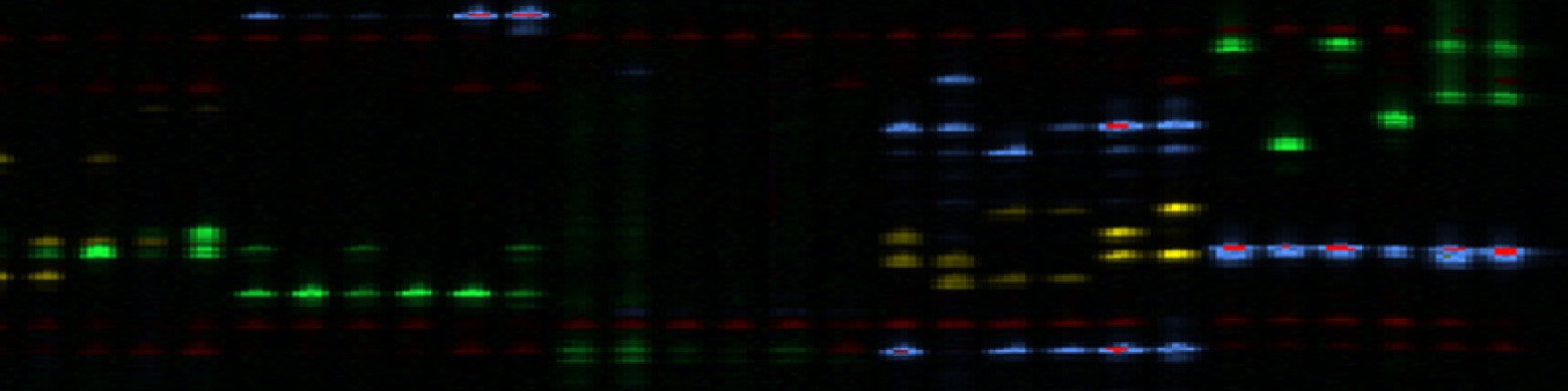 DNA, Microsatellites,  photo by Krissy Bird